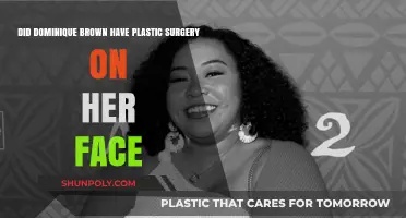 Dominique Brown's Face Transformation: Plastic Surgery Speculations Explored