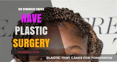 Dominique Brown's Transformation: Plastic Surgery Rumors Explored