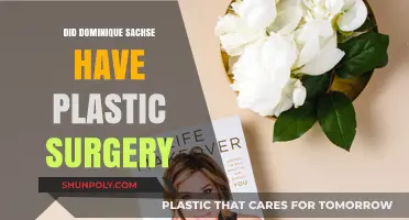 Dominique Sachse's Transformation: Plastic Surgery Rumors Explored