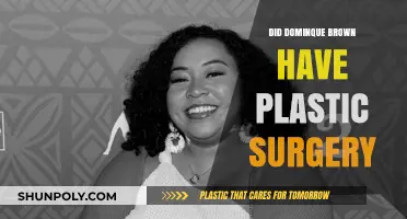 Dominique Brown's Transformation: Plastic Surgery Rumors Explored and Debunked