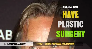 Don Johnson's Transformation: Plastic Surgery Rumors and Reality Revealed
