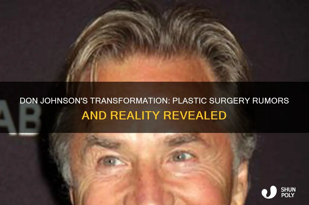 did don johnson have plastic surgery
