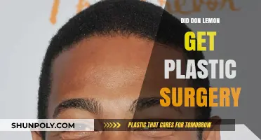Did Don Lemon Undergo Plastic Surgery? Uncovering the Truth