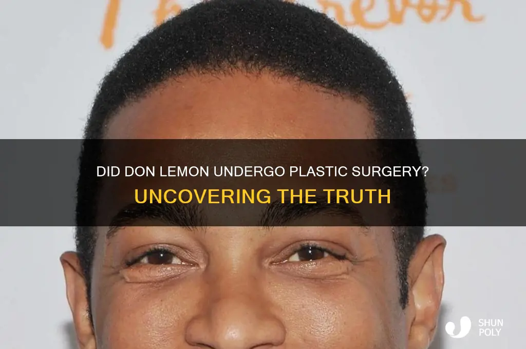 did don lemon get plastic surgery