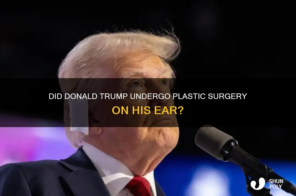 did donald trump get plastic surgery on his ear