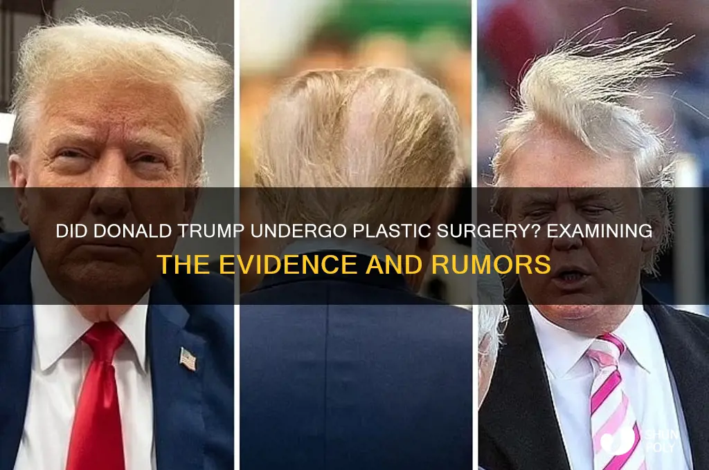 did donald trump get plastic surgery