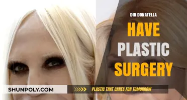 Did Donatella Versace Undergo Plastic Surgery? Unveiling the Truth