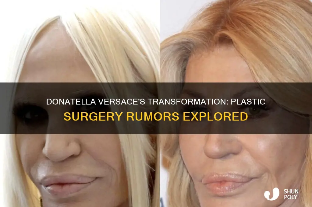 did donatella versace get plastic surgery
