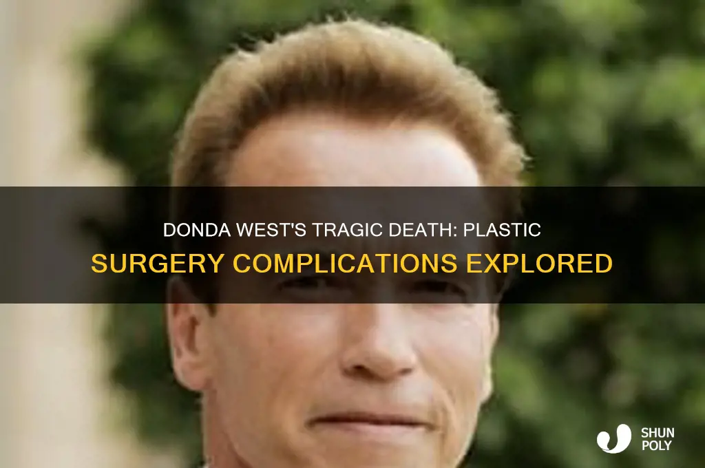 did donda die from plastic surgery