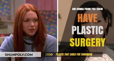 Donna from That '70s Show: Plastic Surgery Rumors Explored