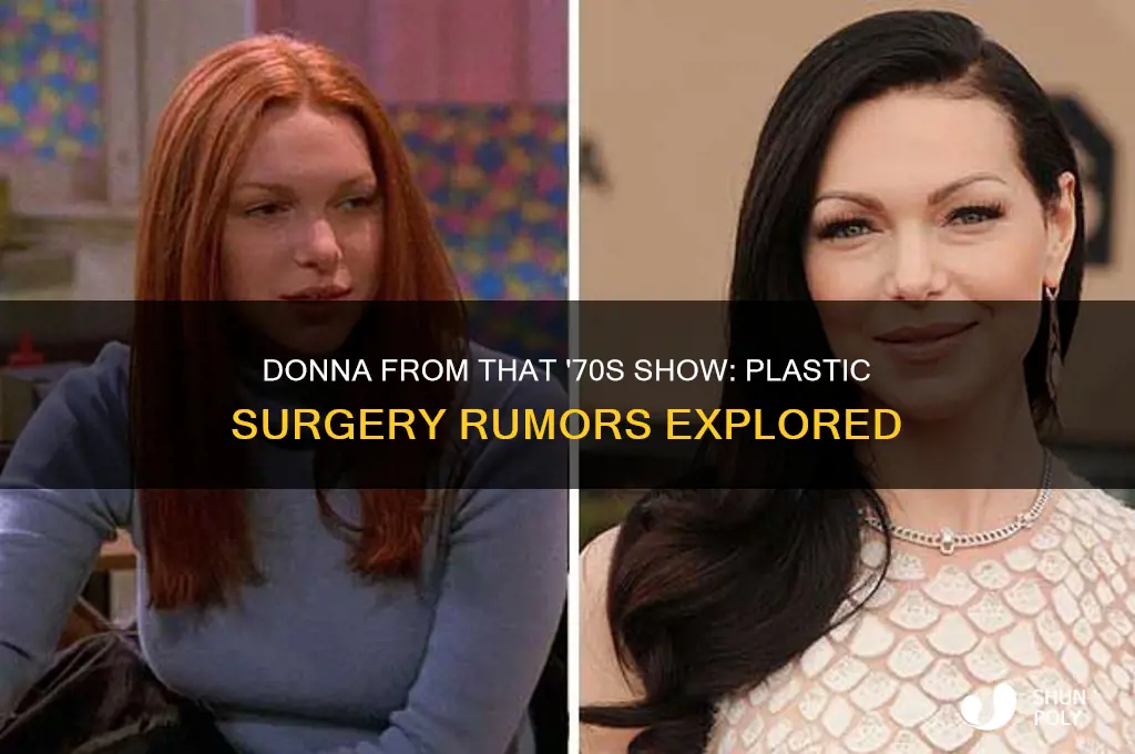 did donna from 70s show have plastic surgery