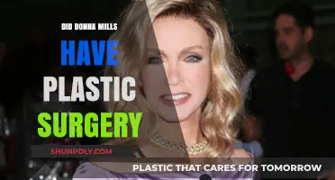 Donna Mills Plastic Surgery: Fact-Checking the Rumors and Speculations