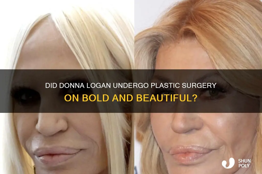 did donna on bold and beautiful get plastic surgery