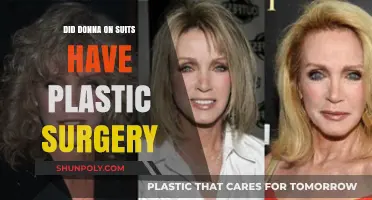 Did Donna on Suits Undergo Plastic Surgery? Unveiling the Truth
