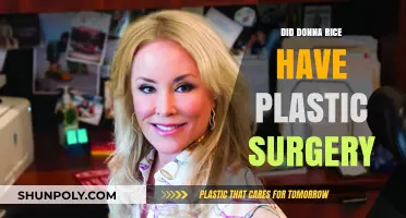 Donna Rice Plastic Surgery: Fact-Checking the Rumors and Speculations