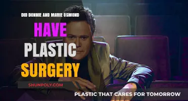 Donnie and Marie Osmond's Transformation: Plastic Surgery Speculations Explored
