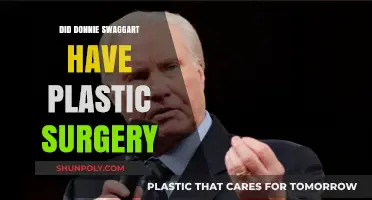 Did Donnie Swaggart Undergo Plastic Surgery? Unveiling the Truth