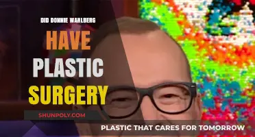 Did Donnie Wahlberg Undergo Plastic Surgery? Unveiling the Truth