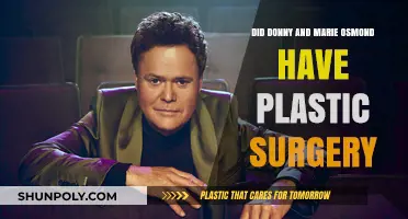 Donny and Marie Osmond: Plastic Surgery Speculations and Truths Revealed
