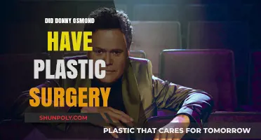 Donny Osmond's Transformation: Plastic Surgery Rumors Explored and Debunked