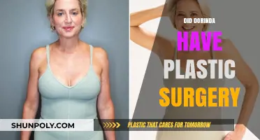 Dorinda's Transformation: Unveiling the Truth About Her Plastic Surgery