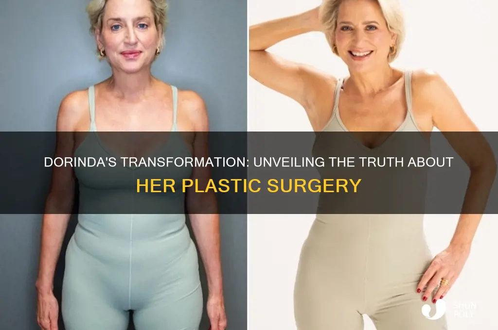 did dorinda have plastic surgery