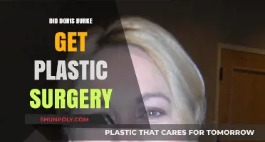 Doris Burke's Appearance: Plastic Surgery Speculations and Facts Revealed