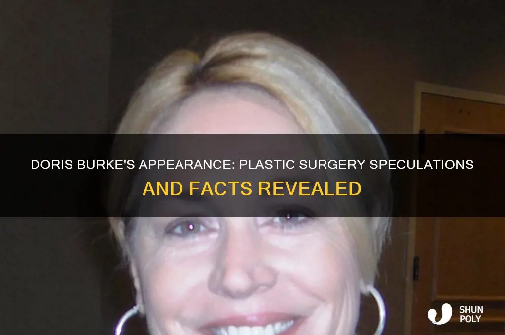 did doris burke get plastic surgery