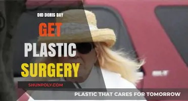 Doris Day's Timeless Beauty: Plastic Surgery Rumors Explored