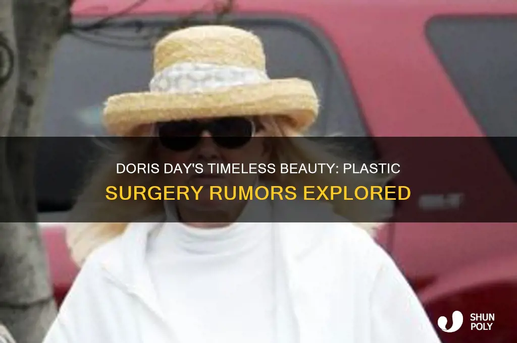 did doris day get plastic surgery