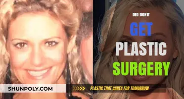 Dorit's Transformation: Plastic Surgery Rumors and Reality Revealed