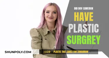 Plastic Surgery Speculation: Did Dove Cameron Go Under the Knife?