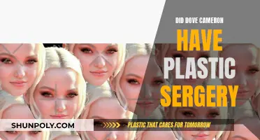 Dove Cameron's Plastic Surgery: Fact or Fiction?