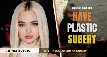Dove Cameron's Plastic Surgery: Fact or Fiction?