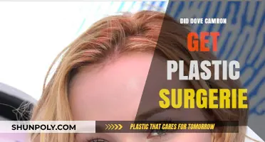 Dove Cameron's Transformation: Plastic Surgery Rumors Explored and Debated