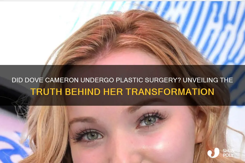 did dove get plastic surgery