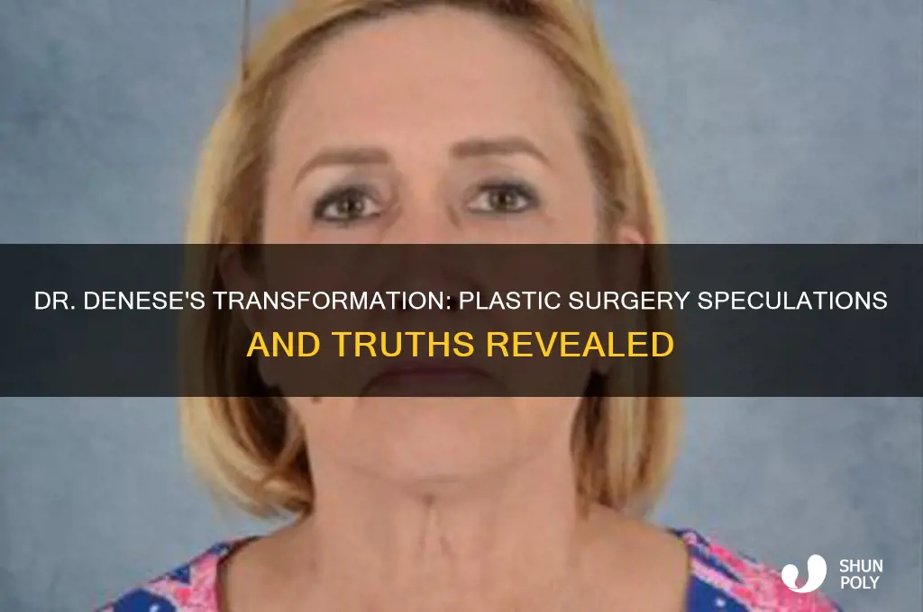 did dr denese had plastic surgery