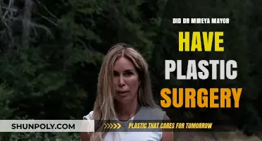 Dr. Mireya Mayor Plastic Surgery: Fact-Checking the Rumors and Speculation
