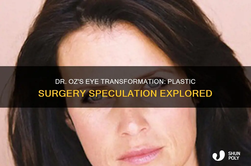 did dr oz have plastic surgery on his eyes