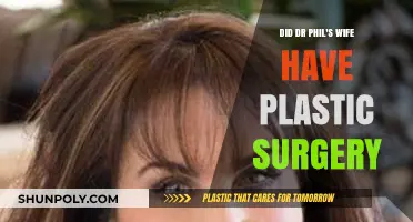 Dr. Phil's Wife: Plastic Surgery Rumors and Reality Revealed