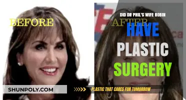 Dr. Phil's Wife Robin: Plastic Surgery Speculations and Truths