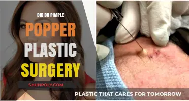 Dr. Pimple Popper's Transformation: Plastic Surgery Speculations Explored