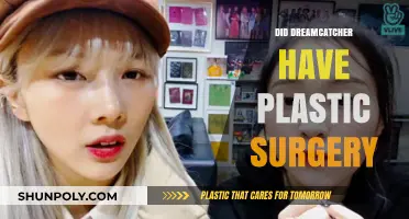 Dreamcatcher's Transformation: Plastic Surgery Rumors and Realities Explored