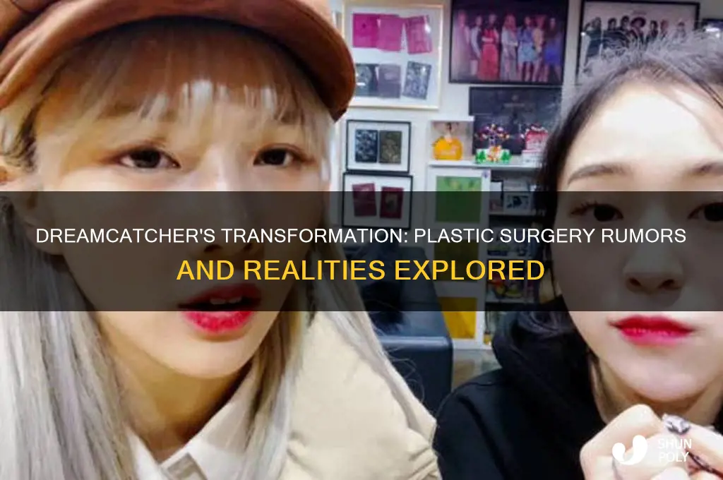 did dreamcatcher have plastic surgery