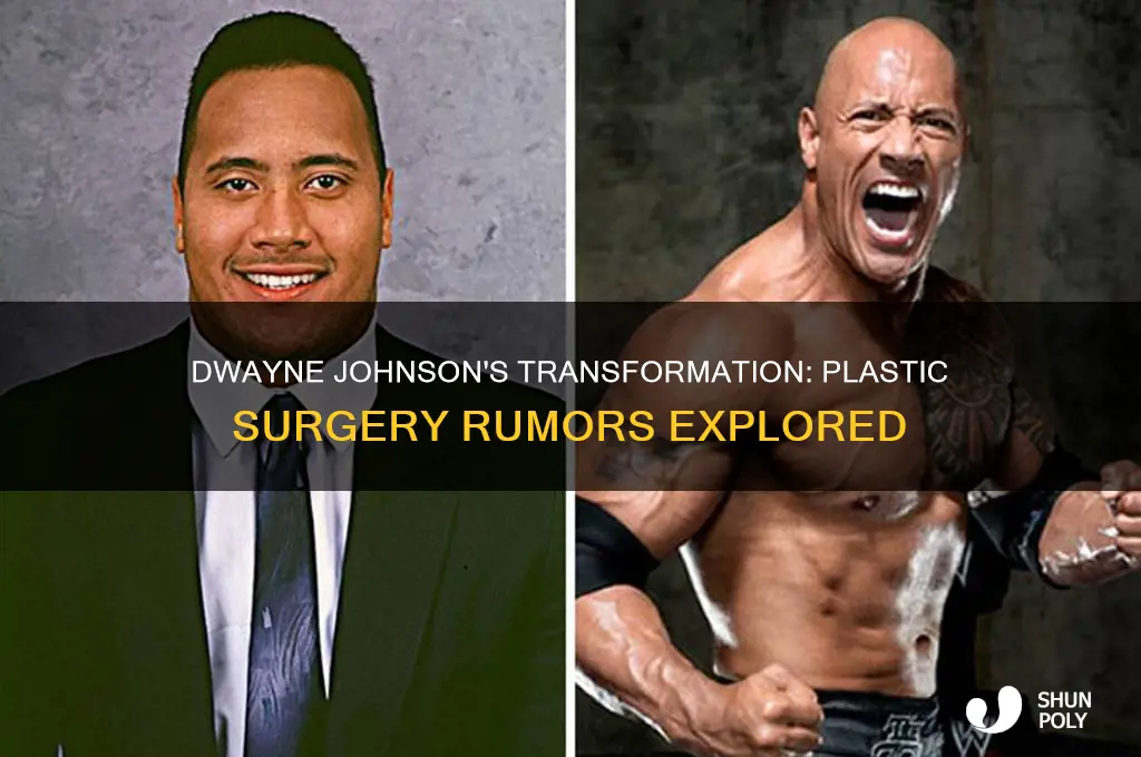 did dwayne johnson get plastic surgery