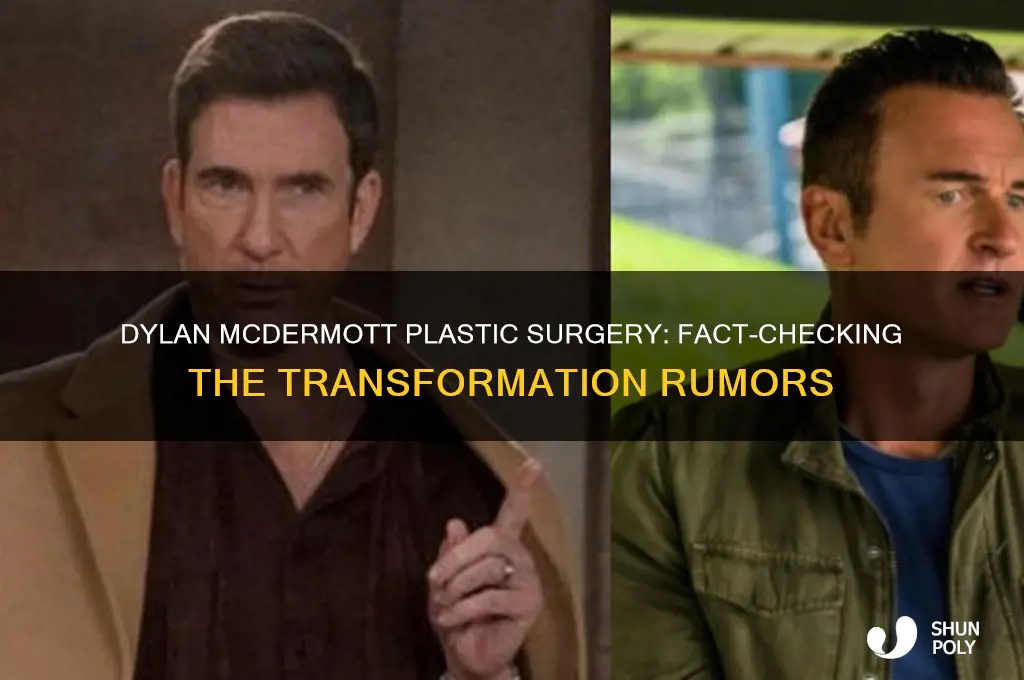 did dylan mcdermott have plastic surgery