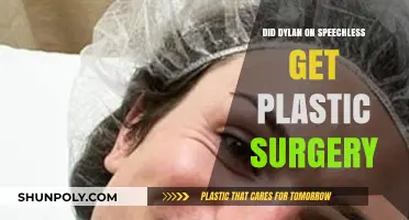 Did Dylan from Speechless Undergo Plastic Surgery? The Truth Revealed