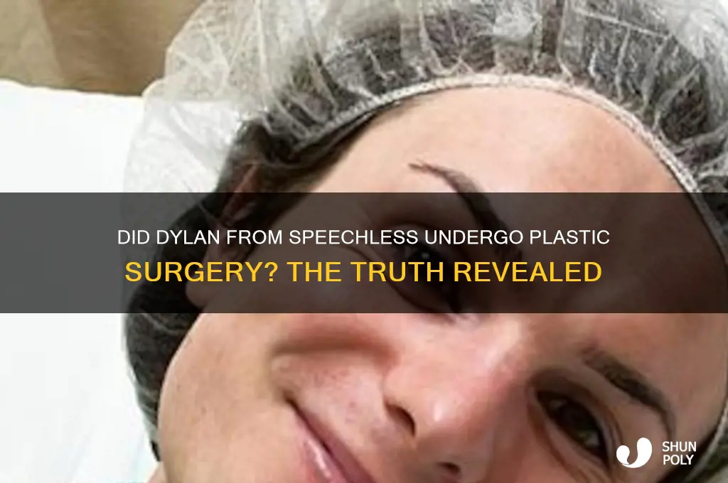 did dylan on speechless get plastic surgery