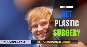 Ed Sheeran's Transformation: Plastic Surgery Rumors Explored and Debunked