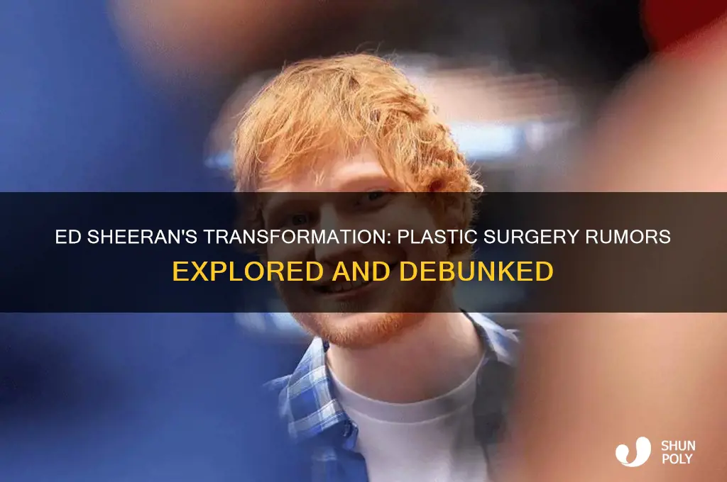 did ed sheeran get plastic surgery